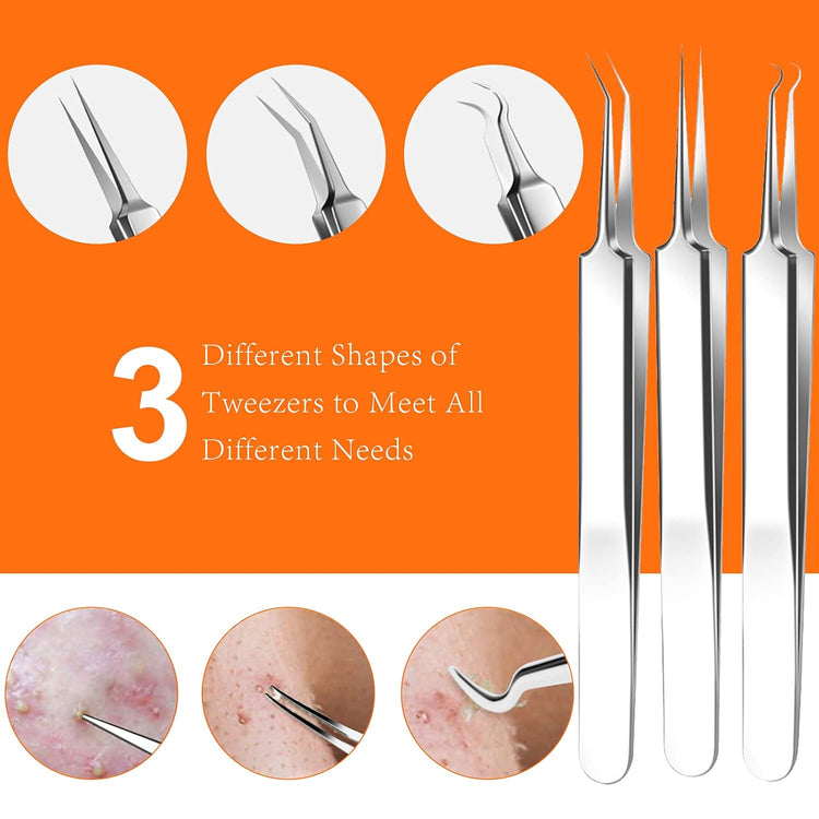 Pimple Popper Tool Kit, 15 PCS Blackhead Remover Comedone Acne Extractor Tools, Professional Sharp Stainless Skin Blemish Removal Pimple Tools with Metal Case